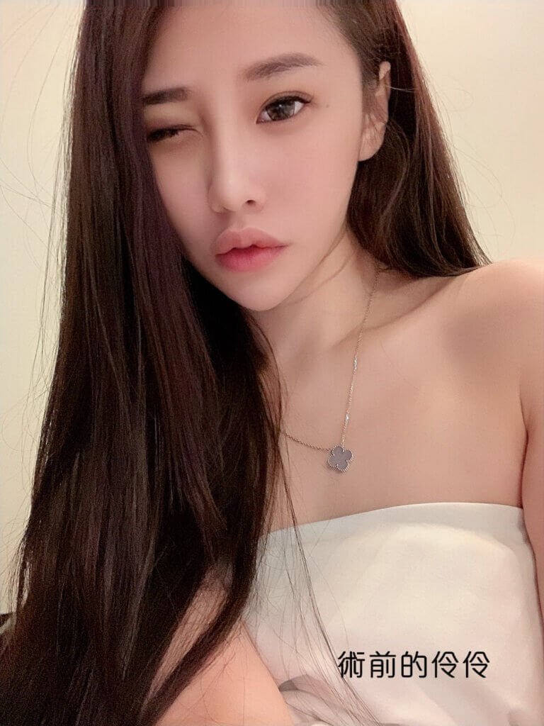 絨毛圓盤隆乳手術