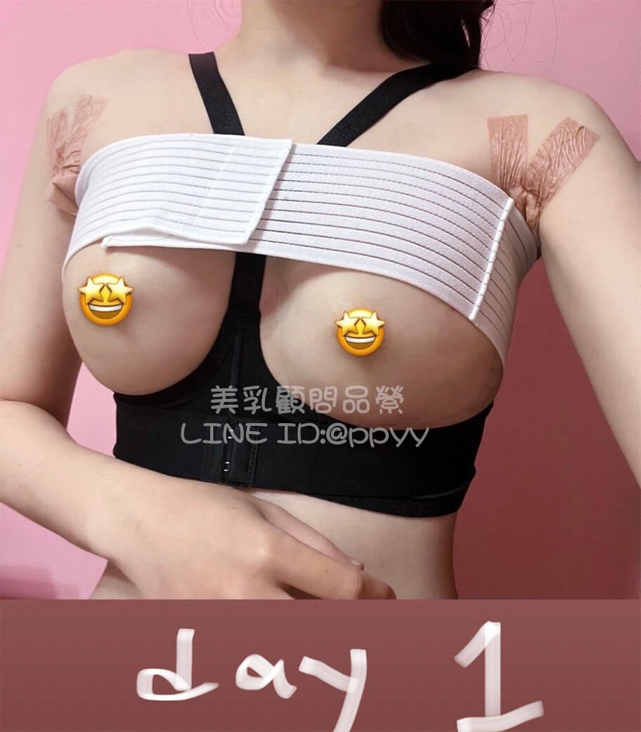 術後第1天